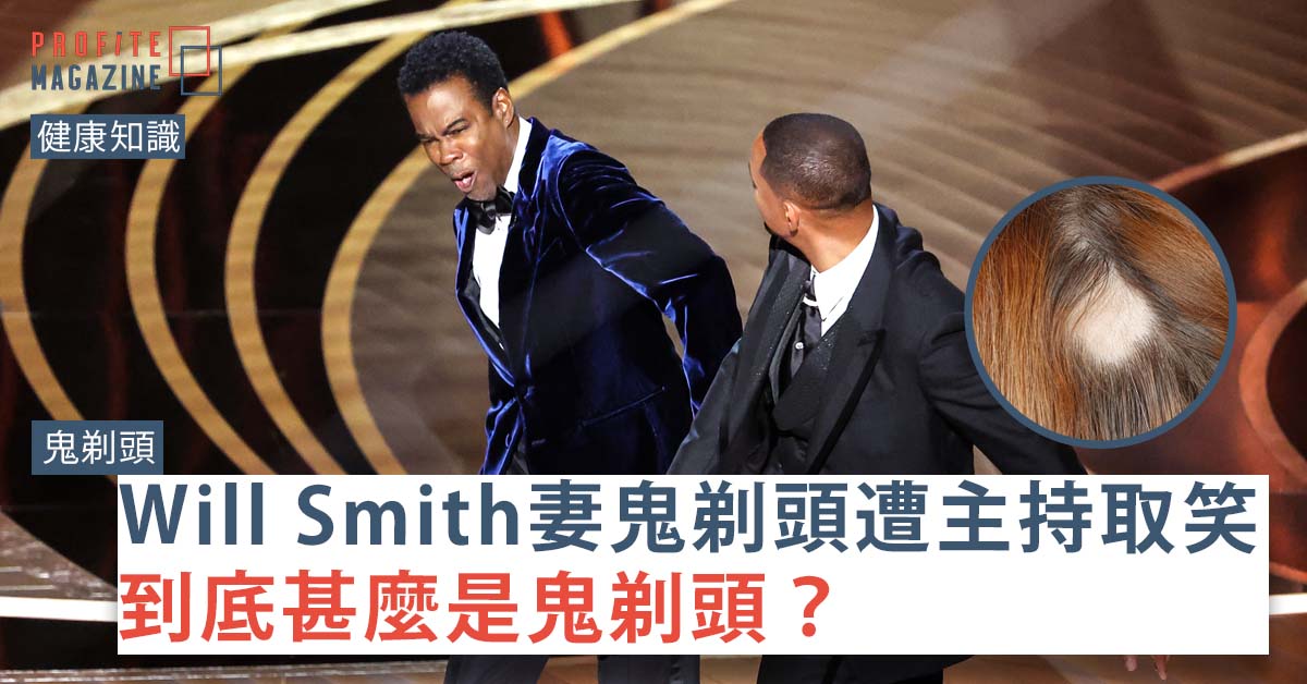 Will Smith 朝 Chris Rock 猛然揮拳